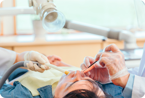 むし歯の部分を取り除く