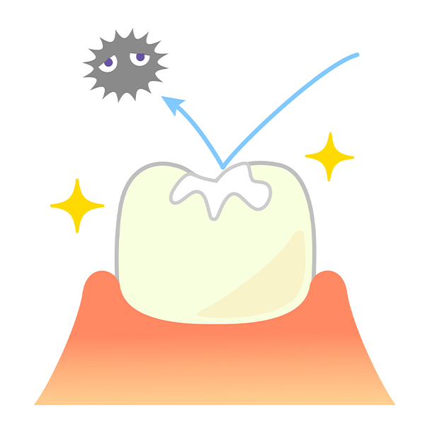 虫歯の進行に応じた治療